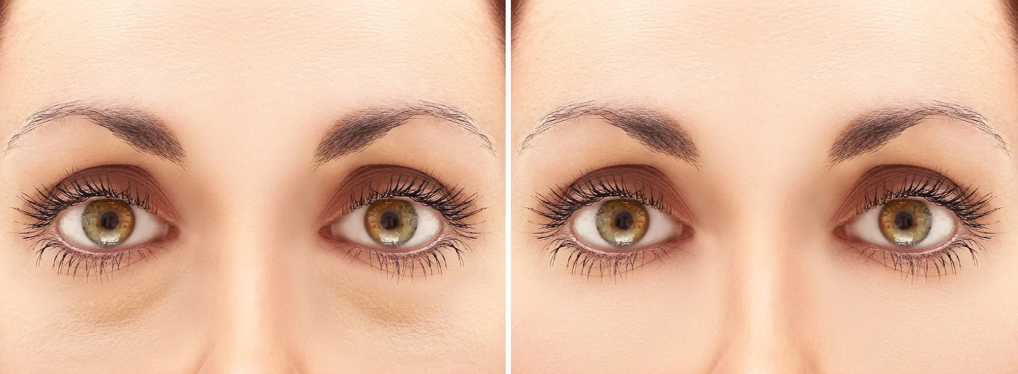 Extraordinary Effective Eye Treatment Set