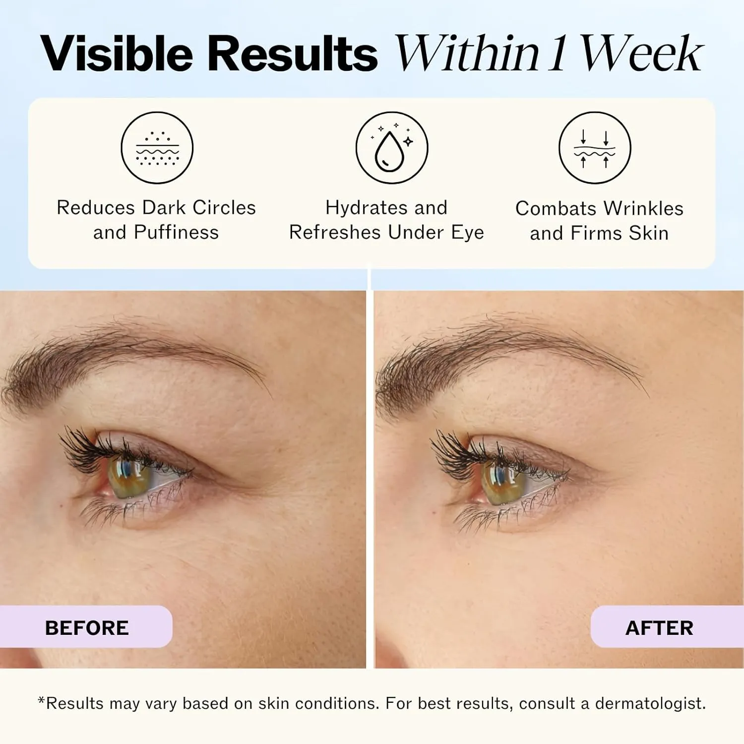 LilyAna Naturals Eye Cream for Dark Circles and Puffiness, Under Eye Cream for Wrinkles and Bags, Anti Aging helps Improve Dryness; for Sensitive Skin (1.7 Ounce, Pack of 2)