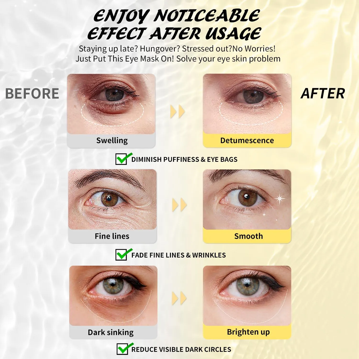 Under Eye Patches (50 Pairs), Hyaluronic Acid Eye Masks for Dark Circles Puffy Eyes Undereye Bags, Collagen Eye Patches for Wrinkles and Hydrate, Skin Care Gift for Her